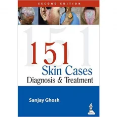 151 Skin Cases: Diagnosis & Treatment by Sanjay Ghosh. Paperback. 2/e 2014